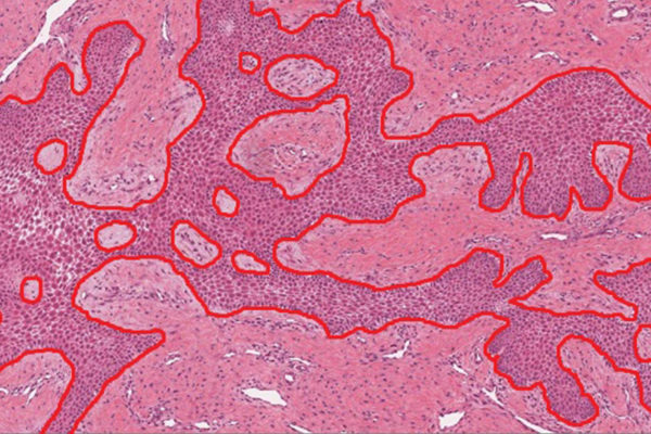 10+ best pathology resources for tissue image analysis