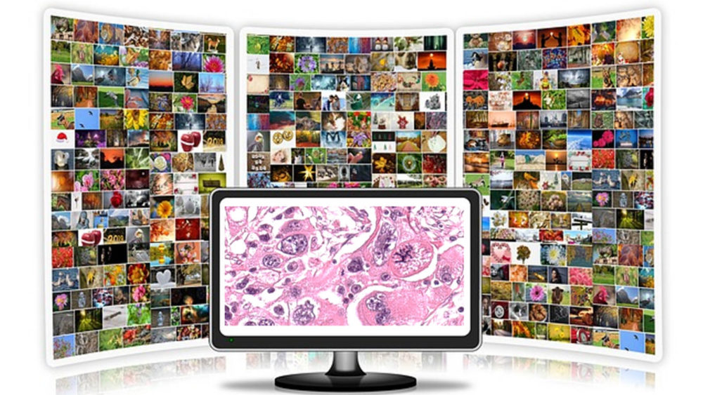 Open source software programs for image analysis of pathology slides digital pathology place