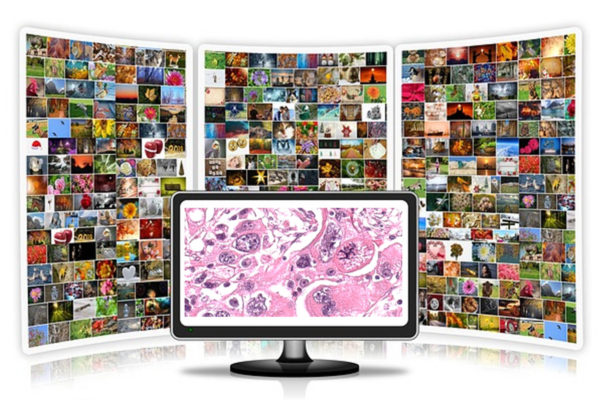 8 free open source software programs for image analysis of pathology slides