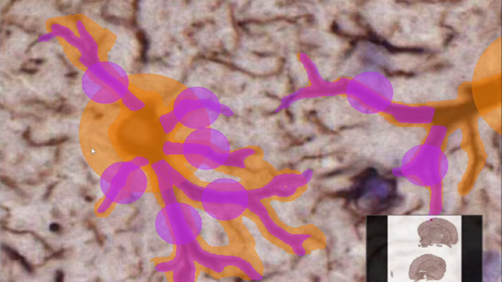 Instance segmentation markups of the microglial cell processes generated in Aiforia