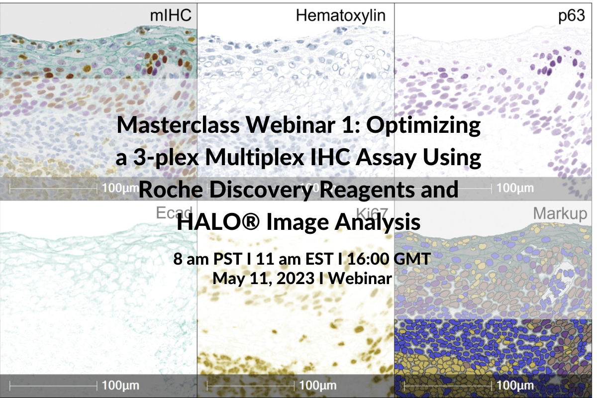 Masterclass Webinar 1: Optimizing a 3-plex Multiplex IHC Assay Using Roche Discovery Reagents and HALO® Image Analysis