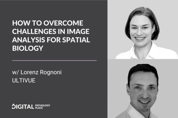 How To Overcome Challenges in Image Analysis for Spatial Biology w/ Lorenz Rognoni, Ultivue