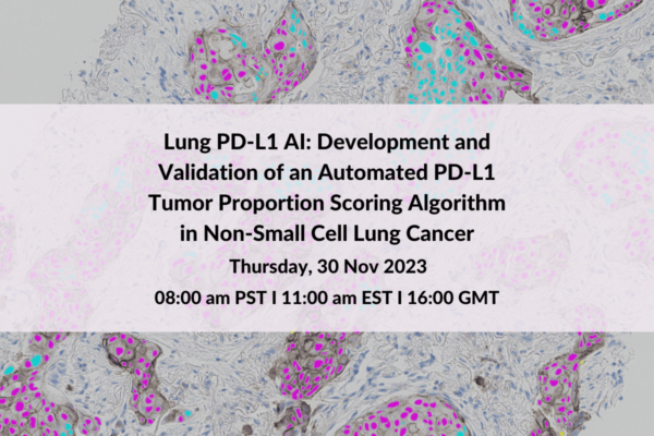 image: Lung PDL1 AI Development and Validation of an Automated PDL1 Tumor Proportion Scoring Algorithm in NonSmall Cell Lung Cancer