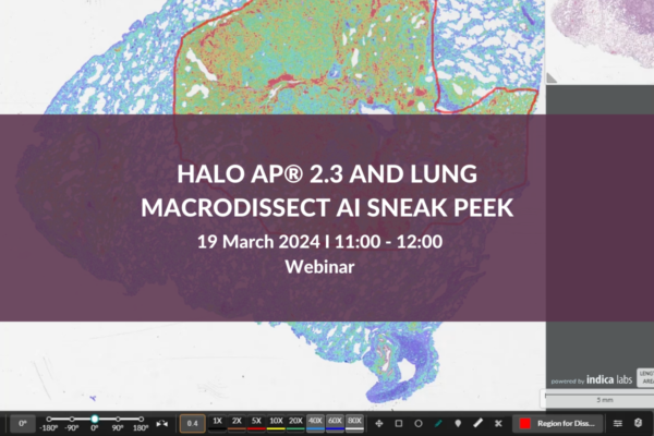 HALO AP® 2.3 and Lung Macrodissect AI Sneak Peek